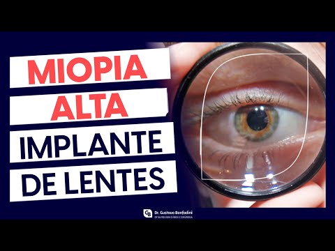 Correction of high myopia and high astigmatism: Phakic Intraocular Lens Implantation - Dr. Gustavo