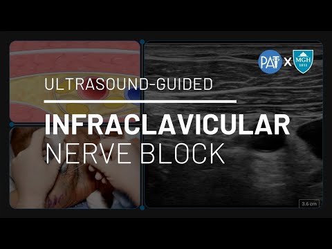 Practical Anesthesia Techniques