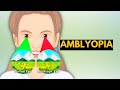 Amblyopia, Causes, Signs and Symptoms, Diagnosis and Treatment.