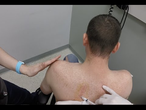 Zurück verletzte Bänder Starke Schmerzen im Rücken zwischen den Schulterblättern