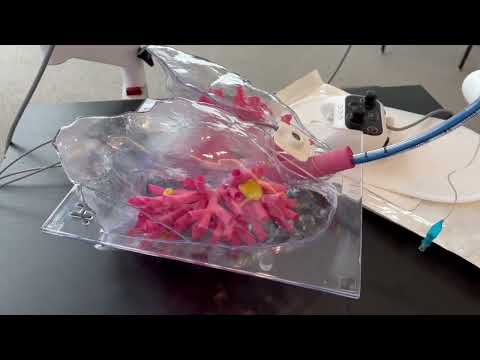 Lung Cancer Detection