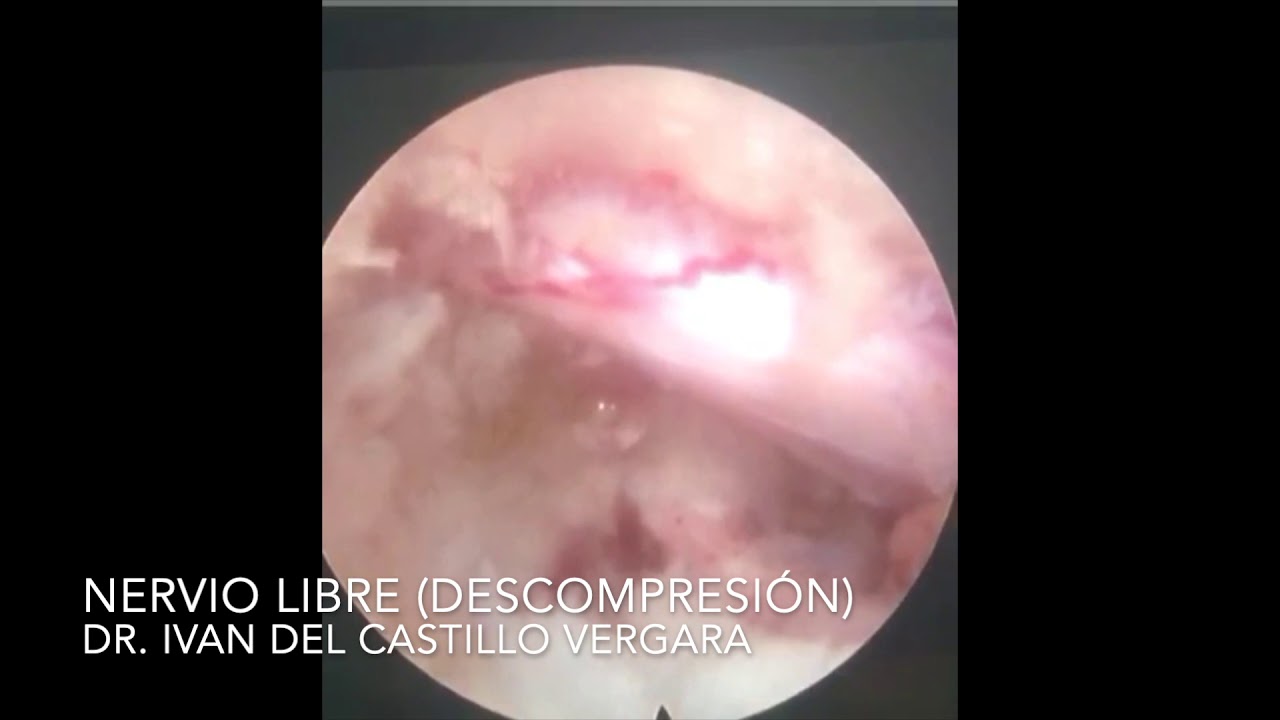 Ivan Del Castillo Vergara-8