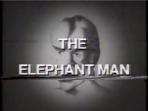 The Elephant Man 1982 ABC Theatre Complete Broadcast
