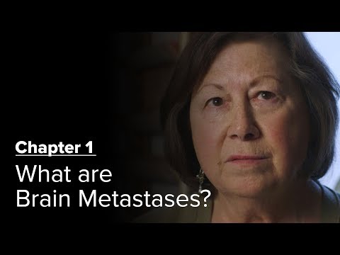 Was ist Arthrose der Hüfte von 1 Grad Dr. Evdokimenko Gelenkschmerzen Macht ändern