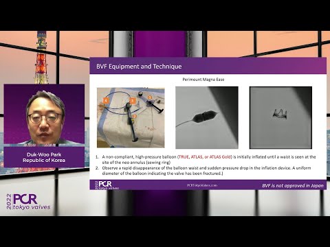 Lifetime management of patients with aortic stenosis