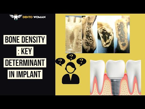 Bone density : in implant | misch classification