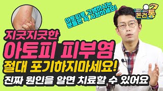 Atopy Completely Explained-How to Fix Atopy 아토피 치료 절대 포기하지마세요! 아토피 없애는 법 진짜 원인을 알아야 된다!