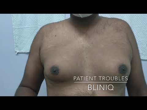 Abdominoplasty (Tummy Tuck) Recovery