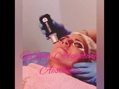 Pigmentary post-parto lo nota Glycyrrhiza - da posti di pigmentary