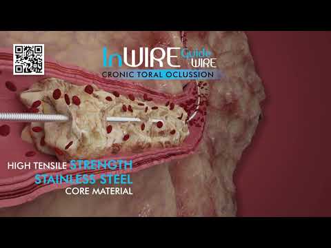 InWire Guidewire CTO