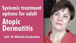 Systemic treatment options for adult Atopic Dermatitis