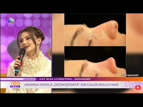 Teo Show (03/28/2022) - Andreea Romila, "disinherited" because of her new nose!