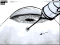4086 A Alcon AILP Animatic 05