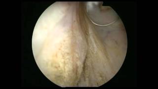 ΑΝΔΡΕΑΣ ΜΑΥΡΙΔΗΣ - Μέθοδος TURIS - ΕΠΕΜΒΑΣΗ ΠΡΟΣΤΑΤΗ