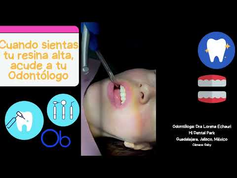 Cuando sientas una resina alta…