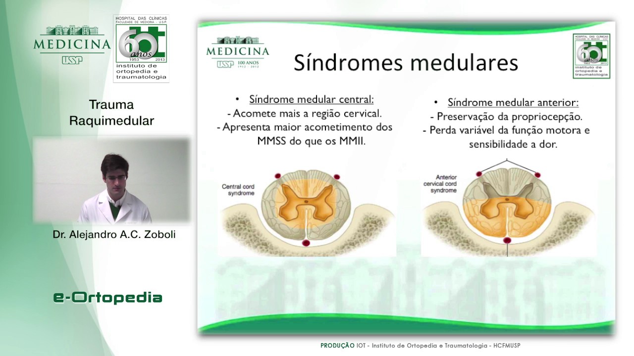 Trauma Raquimedular - Dr. Alejandro A. C. Zoboli