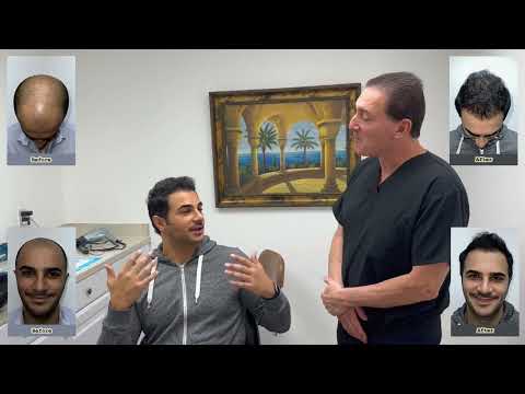 Dr. Brett Bolton performed another excellent Maxharvest Plus Hair Transplant for his patient Igor