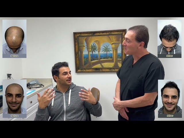 Dr. Brett Bolton performed another excellent Maxharvest Plus Hair Transplant for his patient Igor