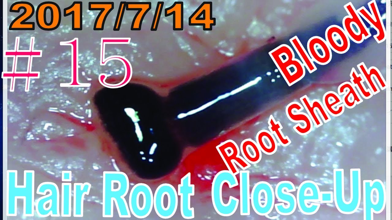 Bloody Hair Image Sharing Site Bloody Hair Image Sharing Site