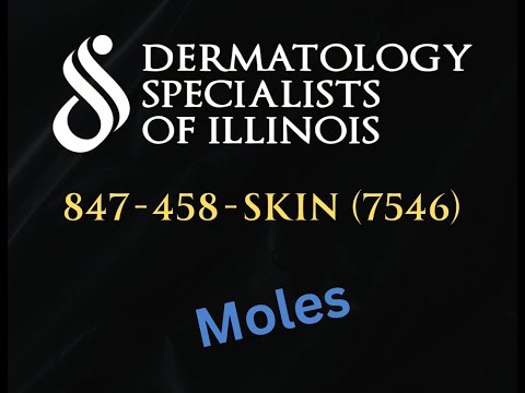 Moles Video