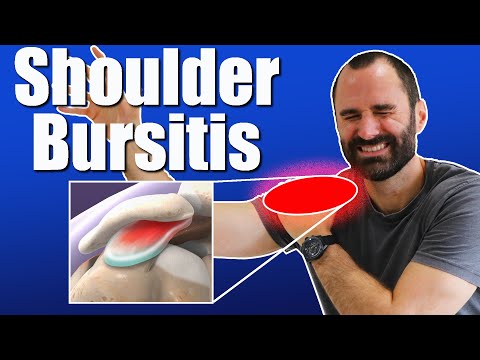 Shoulder Bursitis: Symptoms, Causes, and Effective Exercises for Shoulder Pain