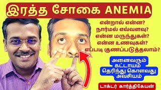 இரத்த சோகை மருத்துவம் | 5 anemia symptoms and treatment | dr karthikeyan tamil