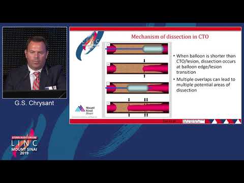 Stern D2 - How to Reduce Dissections in BTK - Dr. George Chrysant