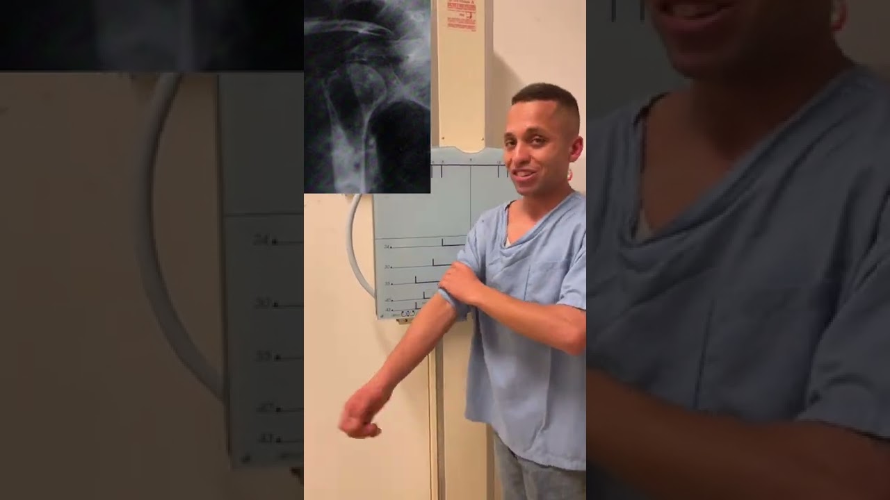 Radiografias de úmero em trauma