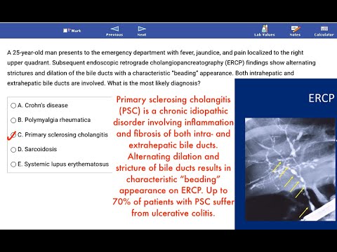 USMLE Practice Questions and Answers #42 I Pharmacology & Pathophysiology