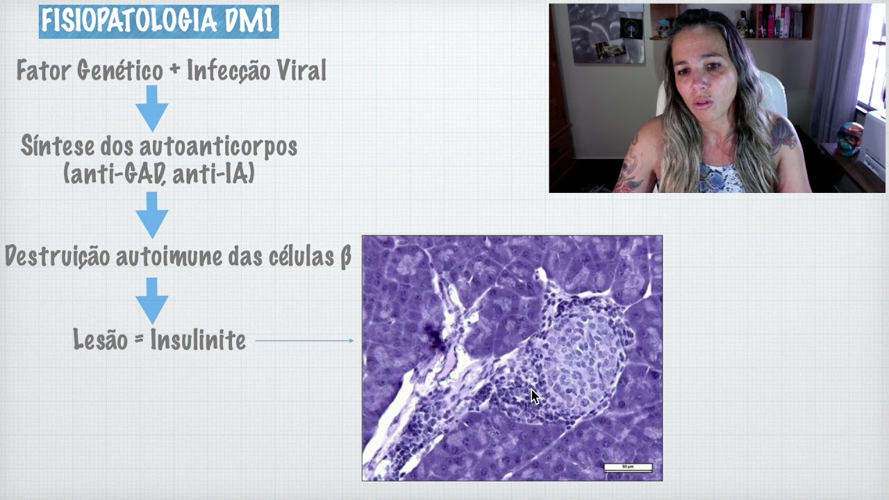 Fisiopatologia do Diabetes Mellitus Tipo 1