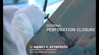 Laparoscopic Duodenal Perforation Closure