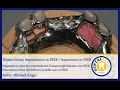 Zahntechnik FREE FULL VIDEO Impressionen In PEEK Impressions In PEEK
