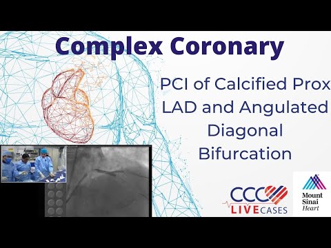 PCI of Calcified Prox LAD and Angulated Diagonal Bifurcation - CCC Live Jan 2017