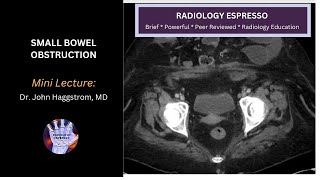 SMALL BOWEL OBSTRUCTION: Mini Lecture, Dr. John Haggstrom, MD