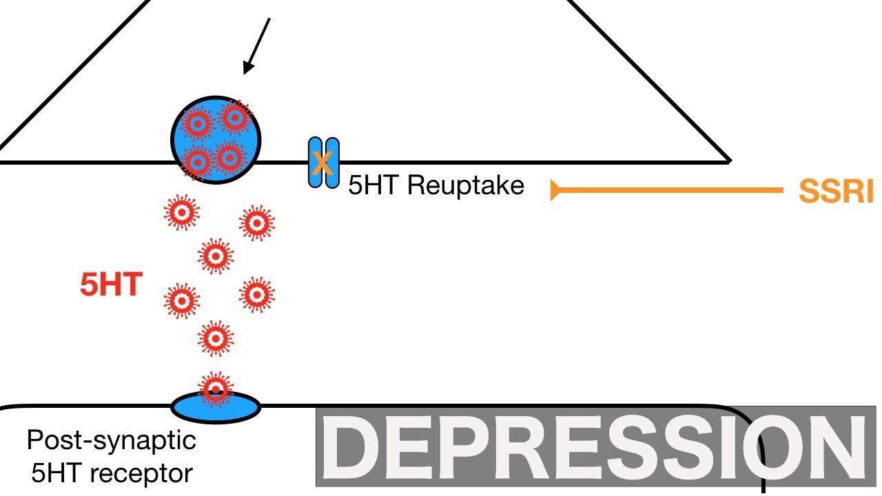 Major Depression and SSRI's/SNRI's