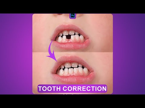 Tooth Correction  in Photoshop - Photoshop For Beginners