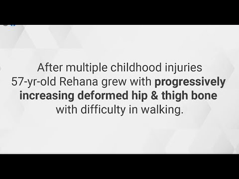 Unveiling a New Dawn of Mobility