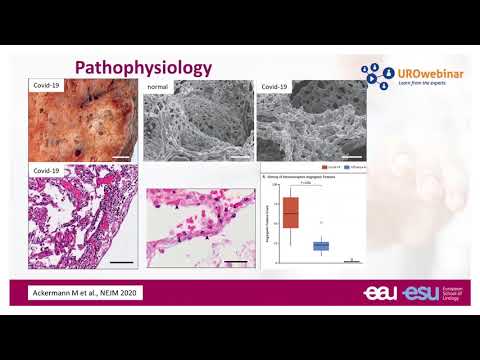 Urowebinar: Dealing with the challenge of infection in urology in the COVID era