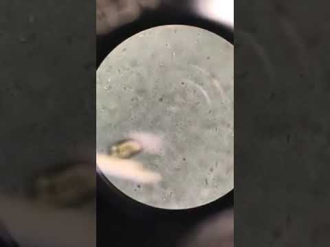Paraziták, amelyek rovarokban élnek