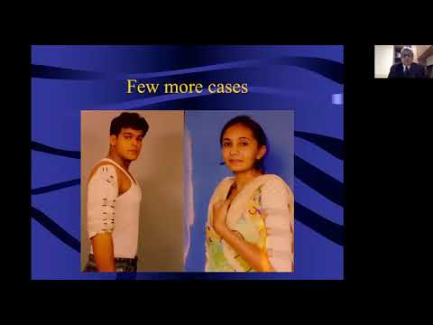 Dr Anil Karkhanis Sarmiento Bracing