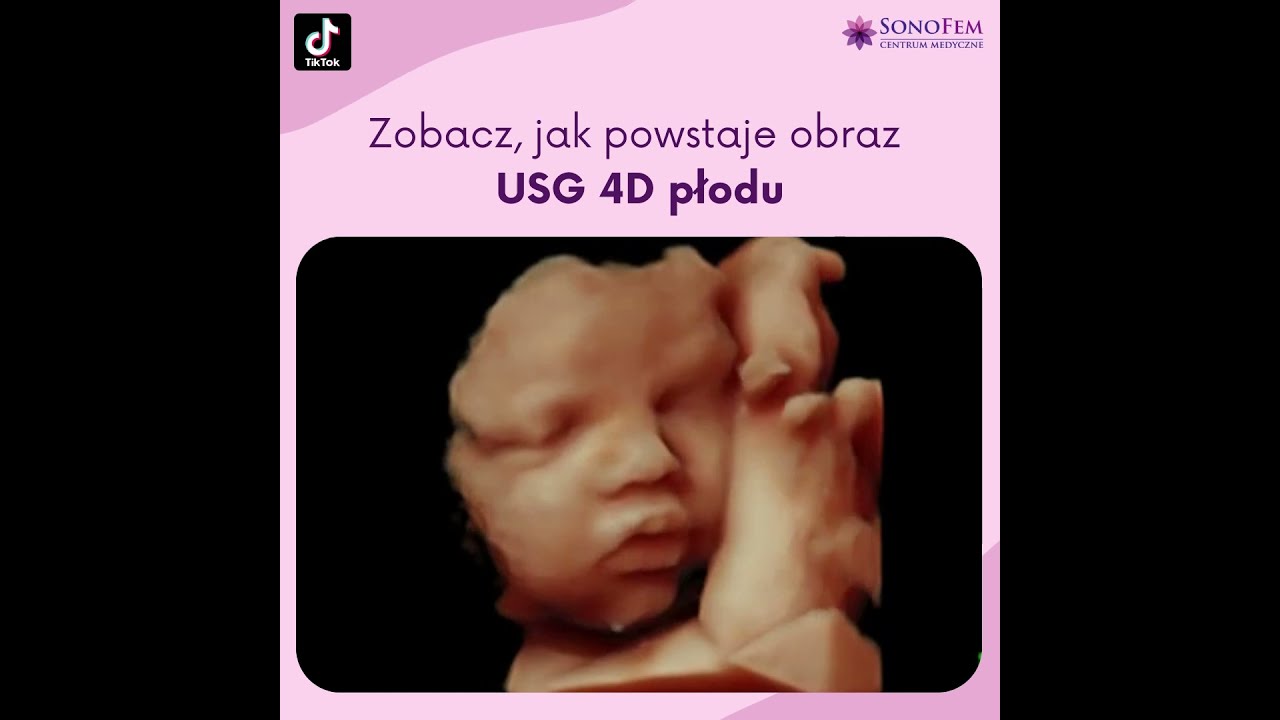 Anita Hamela-Olkowska-7