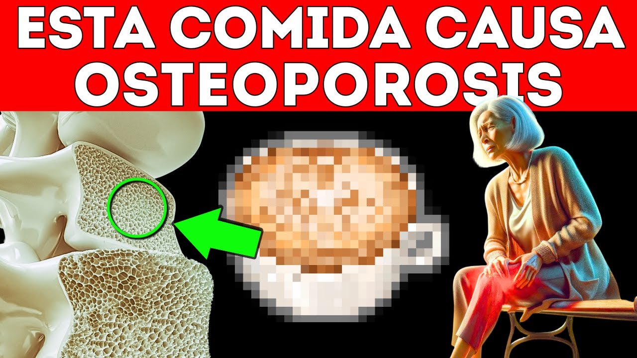 10 ALIMENTOS que CAUSAN OSTEOPOROSIS (HUESOS FRÁGILES)