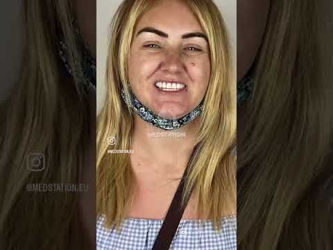 Medstation EU - Get ready for a smile transformation!