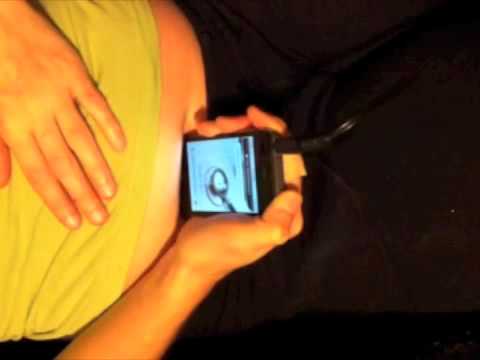 Hear your Babies Heartbeat with an iPhone 4 at home during pregnancy