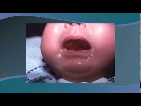 7. Secuencia de Robin