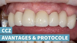 Couronne Céramo-Céramique Zircone : Avantages & Protocole