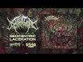 FACELIFT DEFORMATION Geocentric Laceration