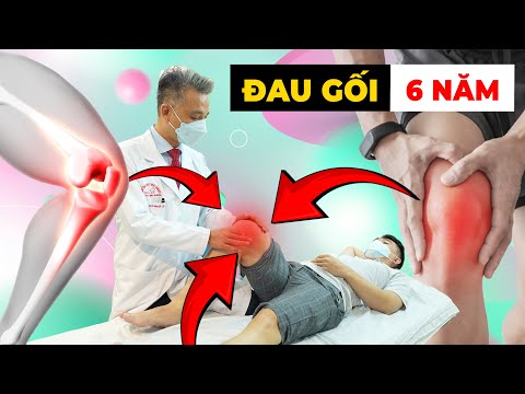 Đau Đầu Gối 6 Năm: Vì Sao Không Khỏi & Giải Pháp Từ Bác Sĩ Chuyên Khoa!