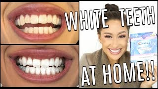 How I Whiten My Teeth At HOME | Does it work Crest 3D White Glamorous White Whitestrips