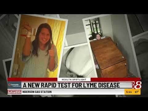 Health Spotlight: A new rapid test for lyme disease